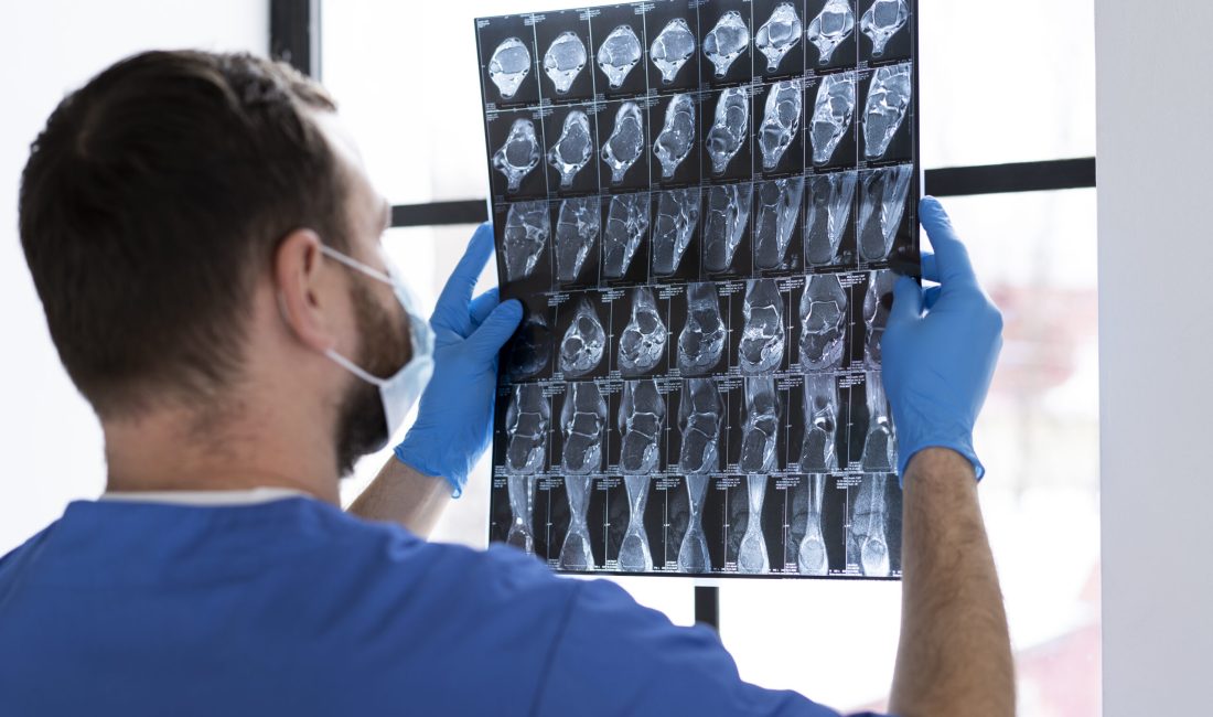 nurse-looking-radiography-side-view