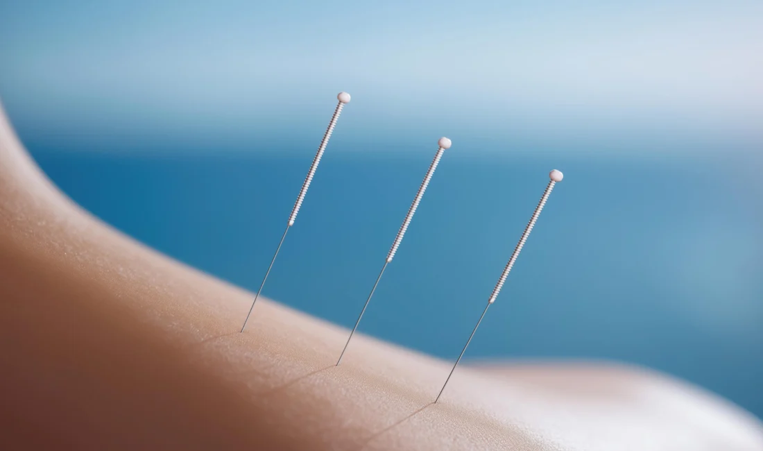 woman-having-physiotherapy-session-scaled (2)